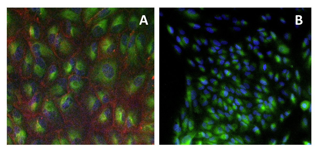 St Petersburg University scientists synthesize new reagents for attaching fluorescent dyes to molecules