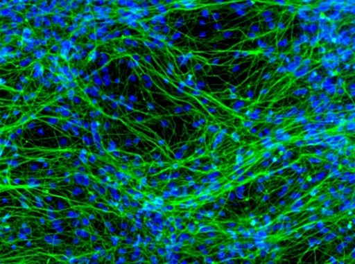 Uncovering Anxiety: Scientists Identify Causative Pathway and Potential Cures